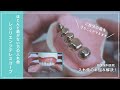 ほとんど歯がない方の入れ歯〜レジリエンツテレスコープ〜