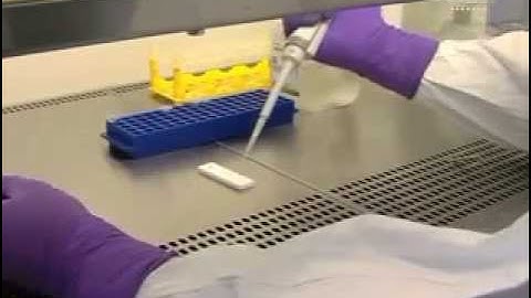 Researchers in France develop 15-minute Ebola test