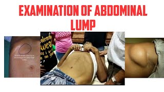 Examination of abdominal lump