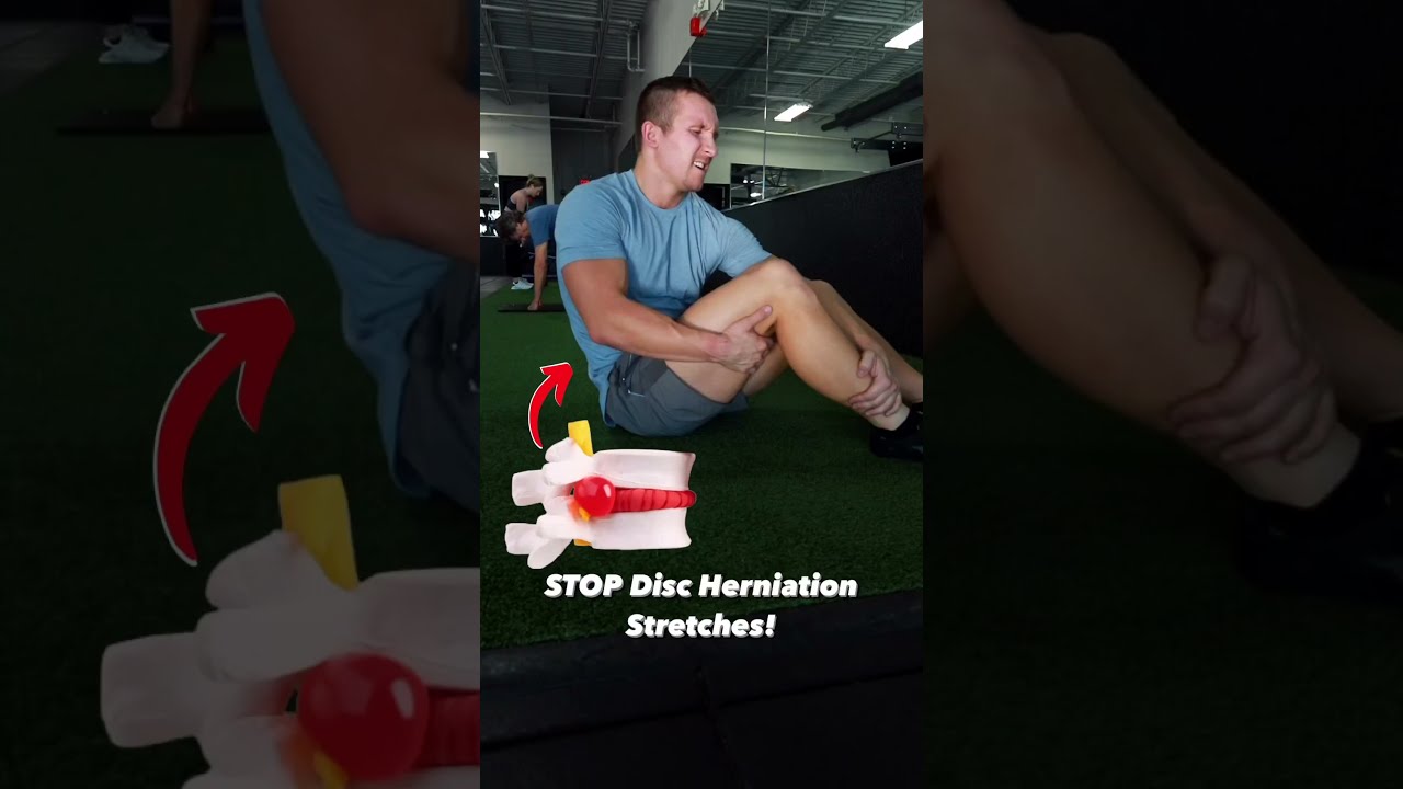 STOP Disc Herniation Stretches 