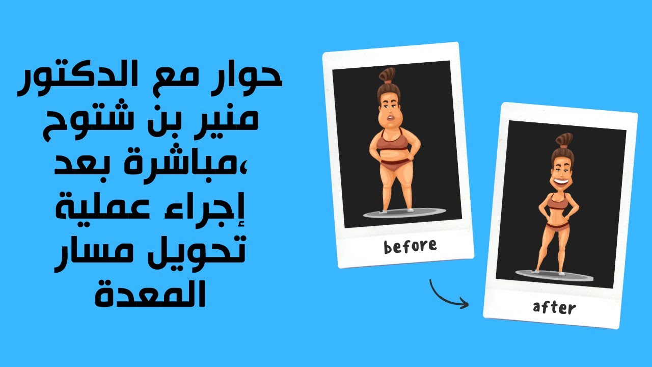 حوار مع الدكتور منير بن شتوح ،مباشرة بعد إجراء عملية تحويل مسار المعدة