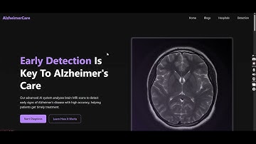 🔥 Alzheimer Detection Using MRI Brain Scans | AI Project with Flask & React | 99% Accuracy | CodeAJ