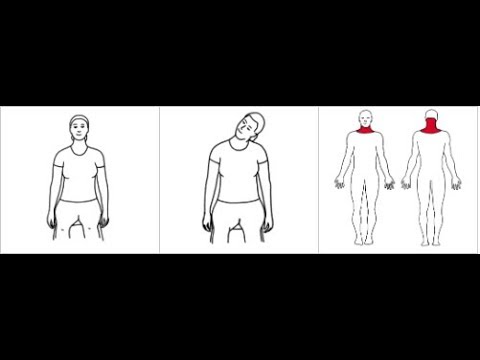 Tøyning av øvre trapezius