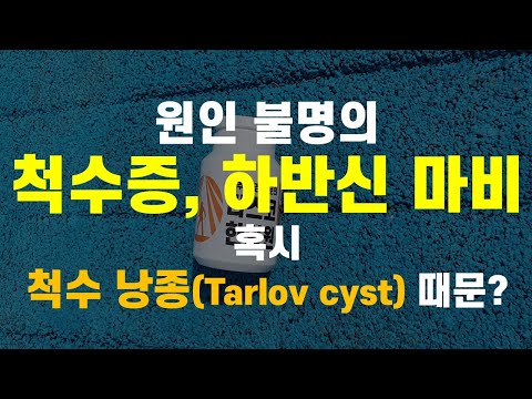 원인 불명의 하반신 마비, 척수증  혹시 척수 낭종Tarlov cyst 때문?