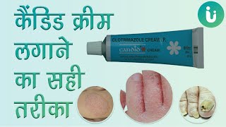 Candid फगल इनफकशन क करम - Candid Cream Ke Fayde, Lagane Ka Sahi Tarika, Uses, Review In Hindi