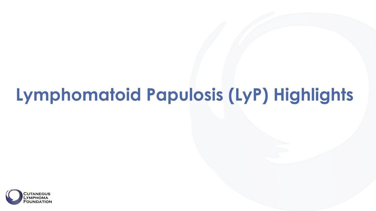 Lyp Diagnosis: Lymphomatoid Papulosis - YouTube