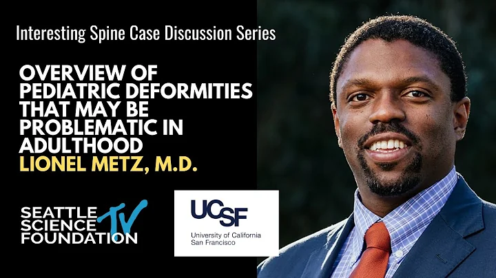 Interesting Case Discussion Series: Overview of Pediatric Deformities - Lionel Metz, M.D.