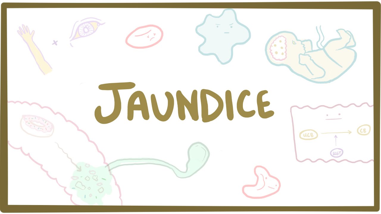 Jaundice - causes, treatment \u0026 pathology