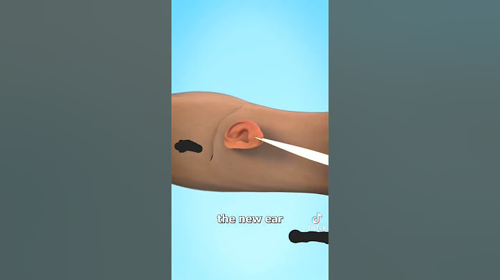 growing an ear in your arm