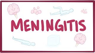 kötőszöveti meningitis)