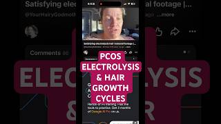 Why your facial hair keeps growing back during electrolysis hair removal | PCOS, PMOS, Hirsutism