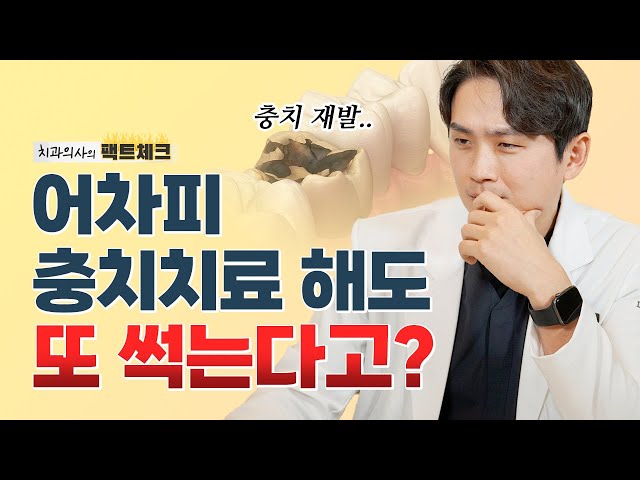 충치치료 했는데 또 충치가 생겼다고??😡 / 2차충치 레진,인레이,크라운