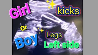 Right side baby movement boy or girl | baby movement in5th month | Left side baby movement boy/girl