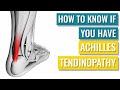 How to Know whether you Have Achilles Tendinopathy - Diagnosis
