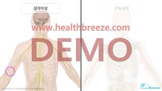 [시연용] a0033aako_회전근개파열의 개념과 치료