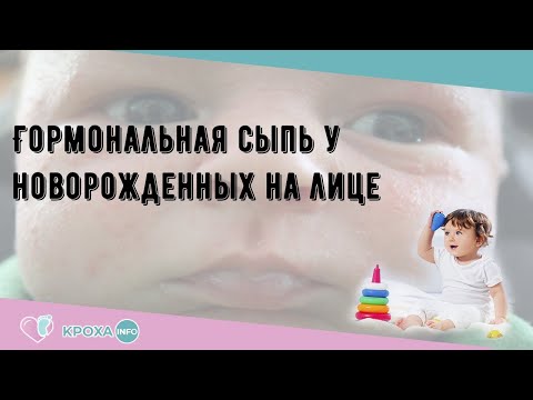 Гормональная сыпь у новорожденных на лице