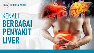 Jenis-jenis Penyakit Liver dan Gejalanya | Hidup Sehat tvOne