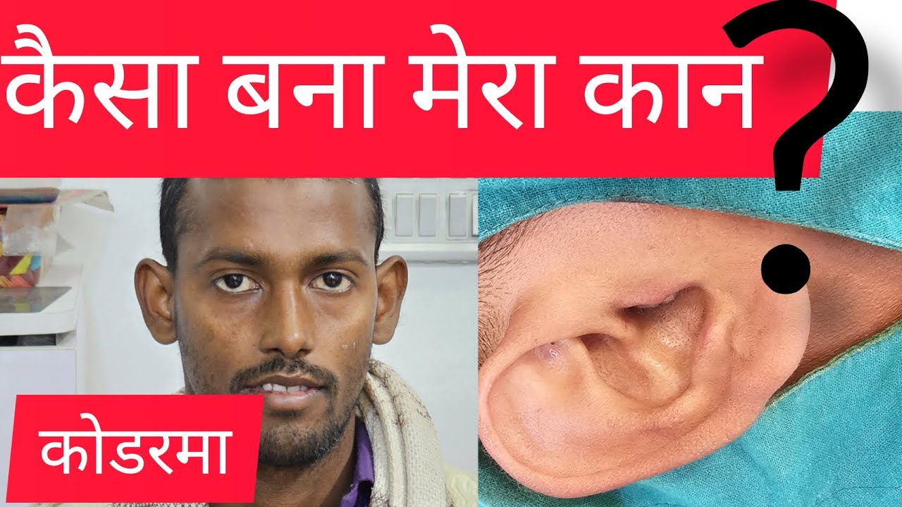 sucessful endoscopic ear 👂 surgery;ashokbest jaipur 88245 44291 endoscopic ear surgery YouTube