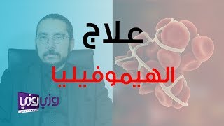 كيف يمكن علاج مرض الهيموفيليا