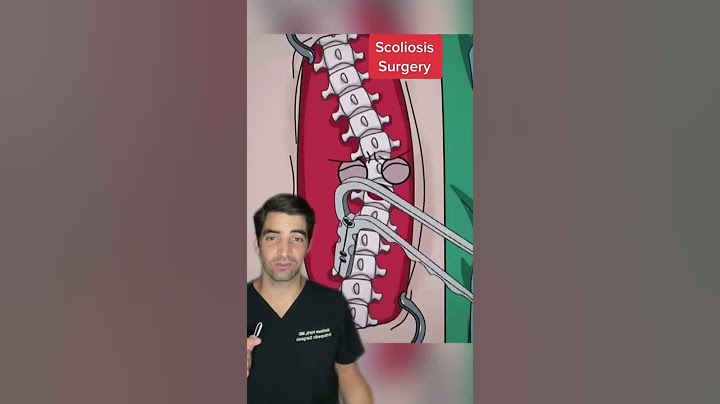 Scoliosis Surgery