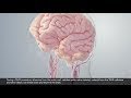 3d animation of sentinel cerebral protection system