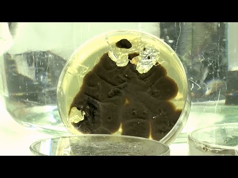 真菌可望減少環境污染 德研究：可加速分解特定塑膠｜20240901 全球現場漫遊天下