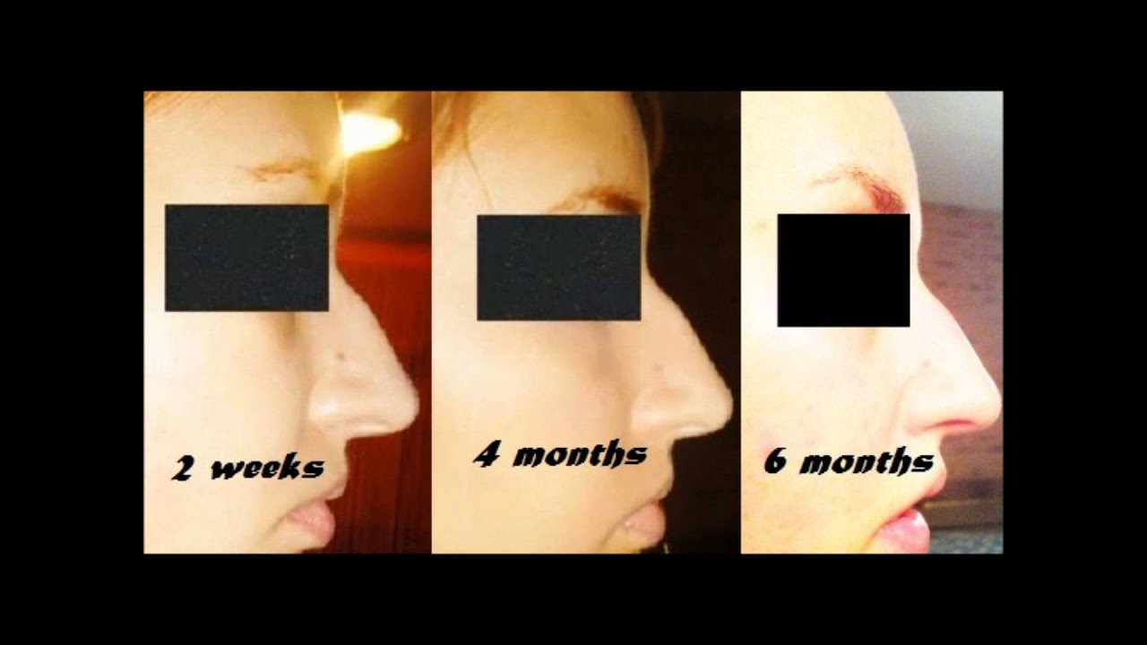 Fashion style How to nasofix wear for long nose for woman Fashion week How to nasofix wear for long nose for lady