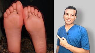 ودع وجع و تنميل و حرقان القدم - افضل تمارين وجع و تنميل القدم - Tarsal Tunnel Syndrome