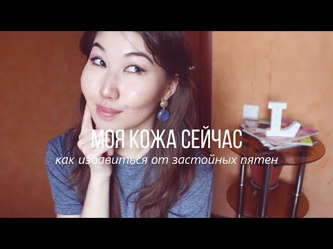 Как я избавляюсь от застойных пятен | Моя кожа сейчас