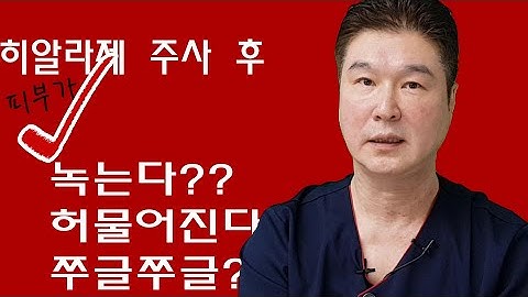 [CN SUB]필러 녹이는 주사인  히알라제를 맞으면 피부가 처진다 ? 피부가 녹는다? 피부가 파인다 ? 동영상을 통해서  히알라제에  대해 확인하시기바랍니다