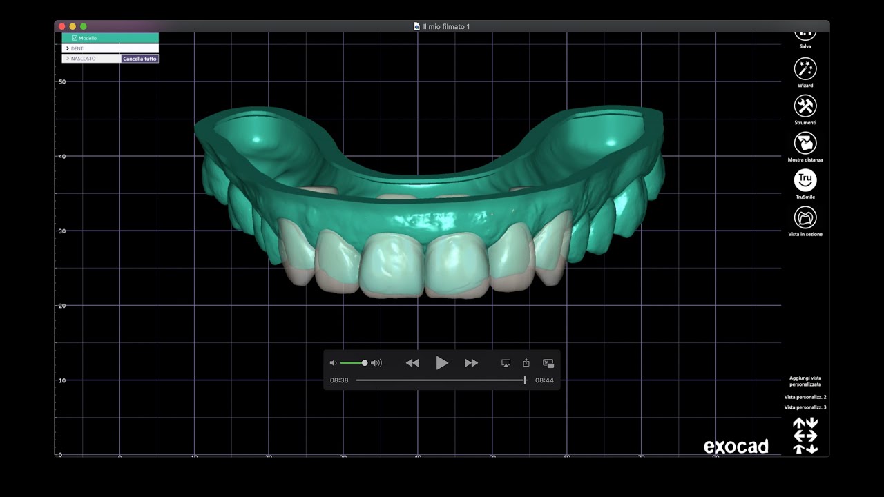 Exocad 10 minutes guide Digital Mock Up ( basic ) Ceratura digitale