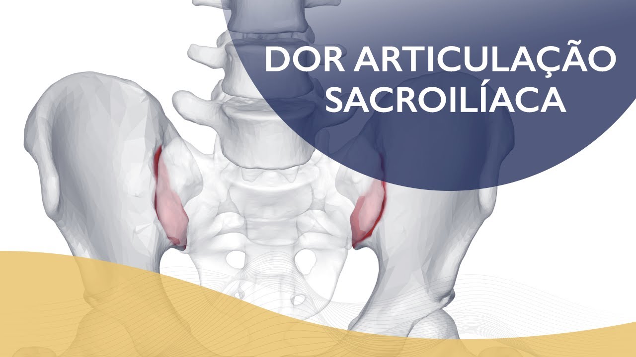 Dor Articulação Sacroilíaca YouTube Dor Articulação Sacroilíaca YouTube