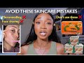 Avoid these 10 skincare mistakes for lighter even skin knuckle cream  asante soap  face shaving
