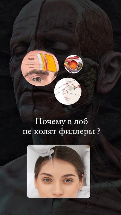 Почему колоть филлеры в лоб опасно ? - YouTube