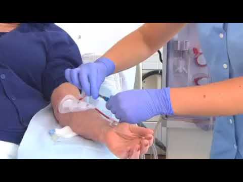 Video: Avansert Planlegging Av Pasienter Med Hemodialyse: En Implementeringsstudie
