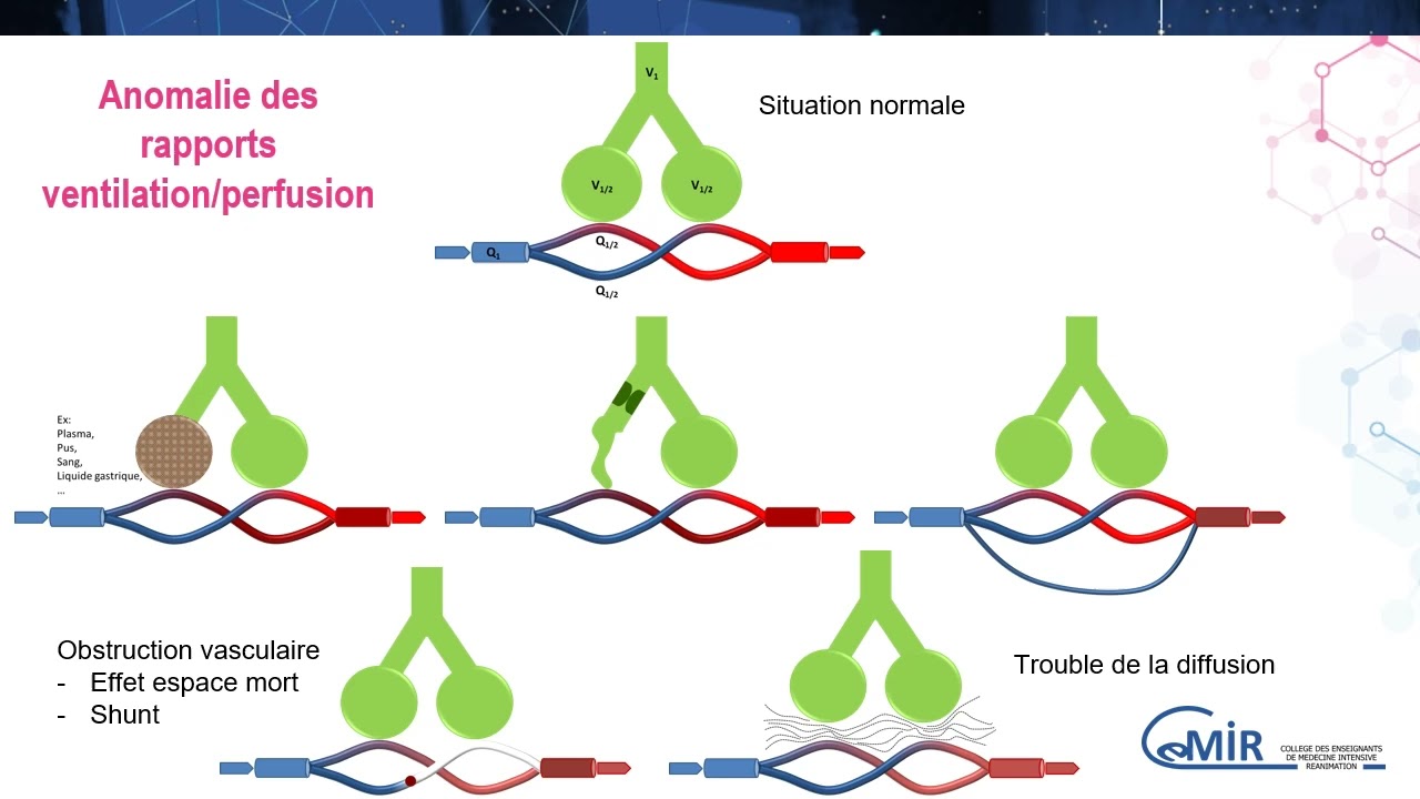 4 20 1 Comprendre la PaO2