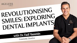 Revolutionising Smiles: Exploring Dental Implants with Dr. Fadi Yassmin