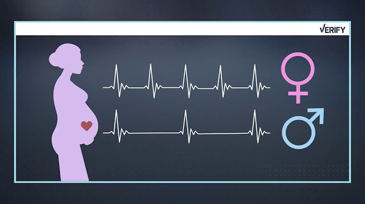 VERIFY: Baby or bust, can you tell the gender?