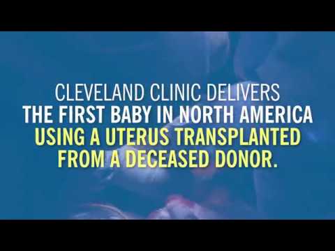 First Baby Delivered in North America Using a Uterus Transplanted from Deceased Donor
