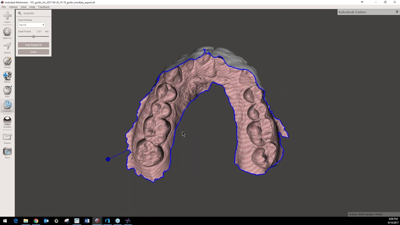 2017 09 14 18 02 CAD CAM Software for 3D Printing in Orthodontics - YouTube