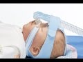 Application video of the BabyFlow plus - the superior solution for non-invasive respiratory support