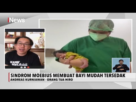 Video: Bolehkah sindrom moebius disembuhkan?