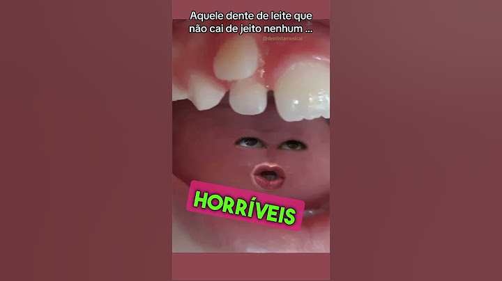 Quem tem dente de leite?