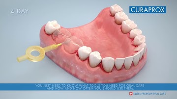 3D animation: How to use an interdental brush correctly