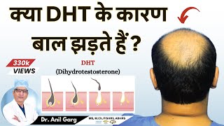 क्या DHT के कारण बाल झड़ते हैं? | Do DHT Causes Hair Loss | Dr. Anil Garg