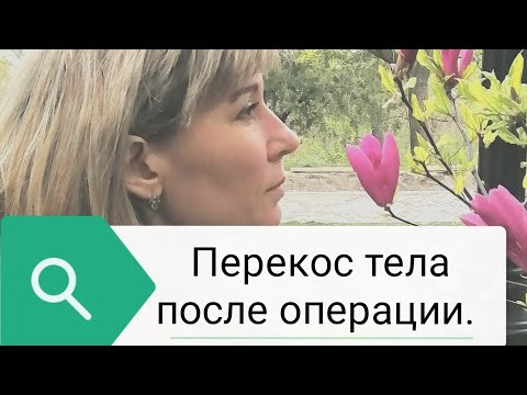 Видео: Намаляване на гърдите - операция, причини, рецензии