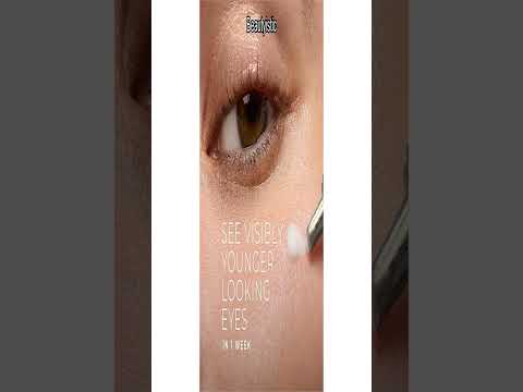 RoC Multi Correxion Under Eye Cream & Retinol Capsules Review: Does It Work?