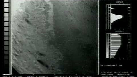 Hubble Space Telescope