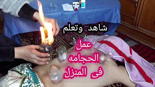 #الحجامه#طريقه عمل الحجامه فى المنزل+طريقه الحجامه الناريه+فوائد الحجامه+انواع الحجامه