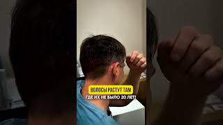 Любая  зона пересадки за 50.000 рублей.